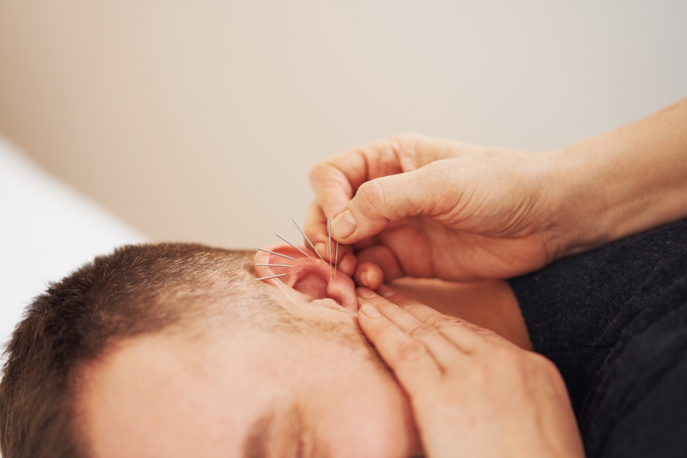 Beitragsbild Ohrakupunktur: Anwendungsbereiche in der Psychotherapie